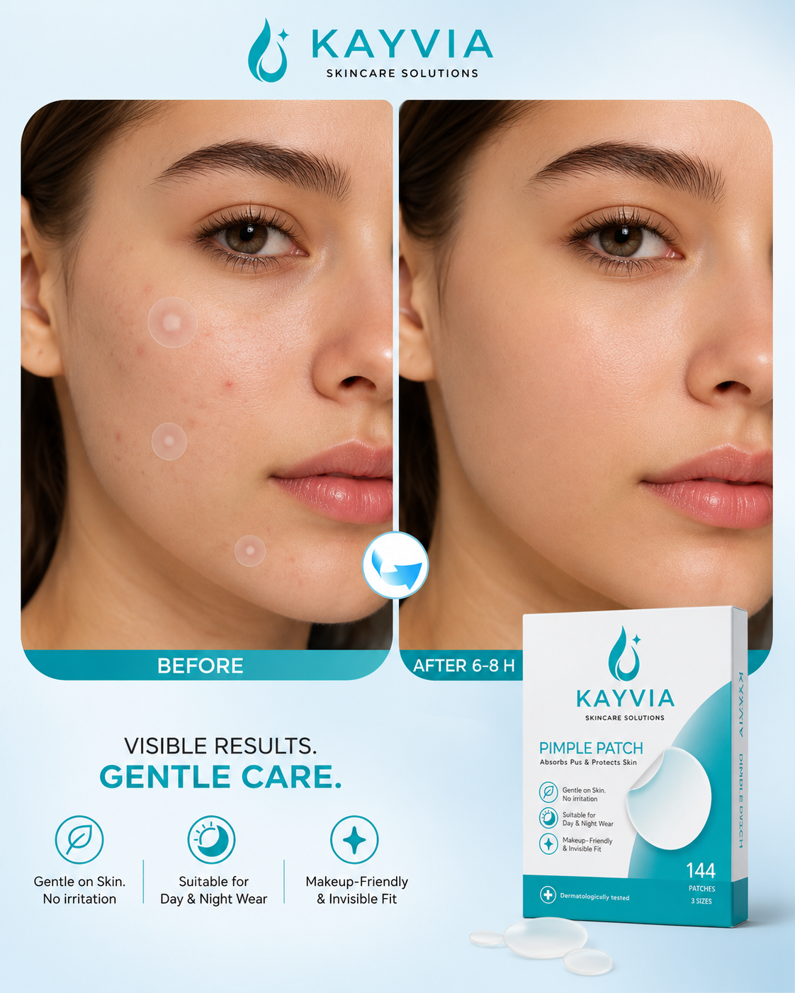 Antes y después con KAYVIA Pimple Patch